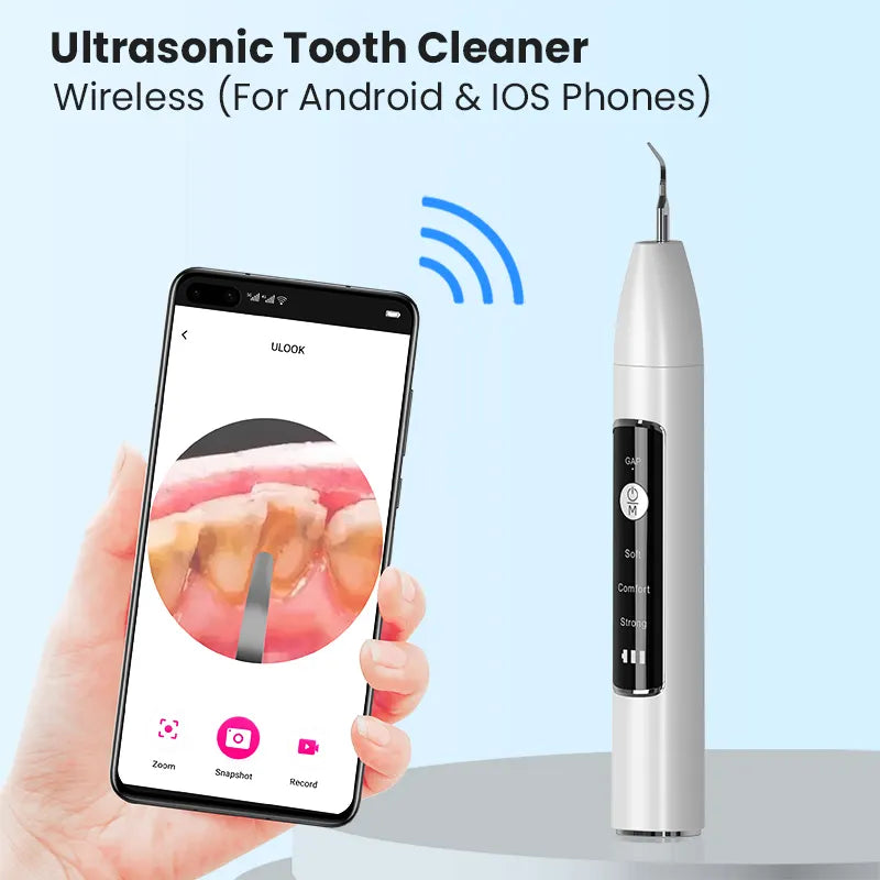 INTELLIGENCE Ultrasonic Tooth Cleaner-J10